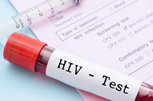 معاون فنی مرکز بهداشت استان خبر داد: اجرای پویش «من هم تست HIV میدهم» در خوزستان