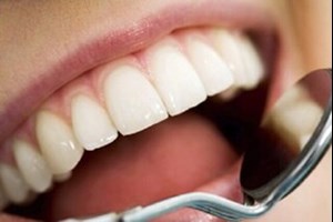 پوسیدگی‌های دندانی و افت عملکرد مغز و قلب / ارتباط بیماری‌های دهان با بروز برخی سرطان‌ها