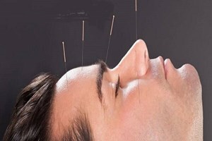 طب سوزنی کدام بیماریها را درمان میکند