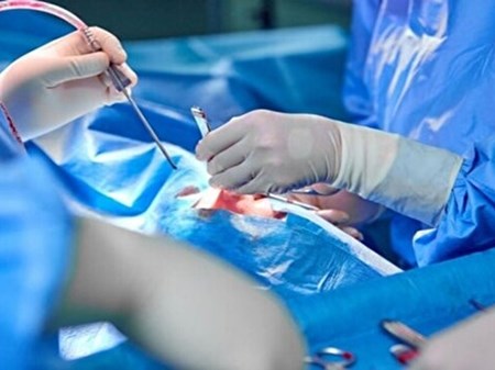 درمان تشنج کودکان با جراحی برای نخستین بار در ایران