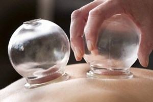 حجامت باعث لاغری و افزایش قد میشود؟