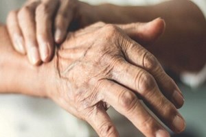 ابتلا به پارکینسون در ایران ۴۰درصد بیشتر از میانگین جهانی