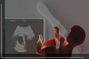 مجازات پزشکانی که سقط جنین انجام میدهند چیست؟